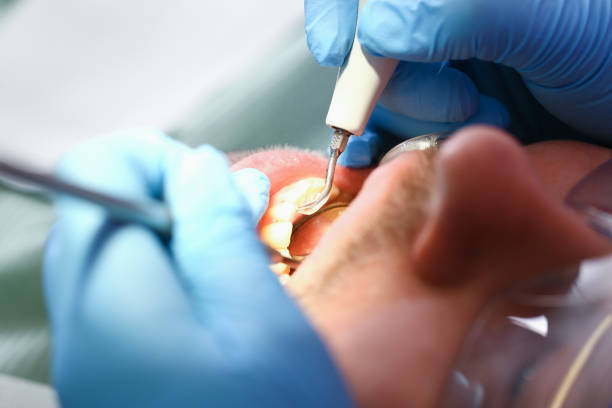 Best Emergency Dental Extractions in Flordell Hills, MO