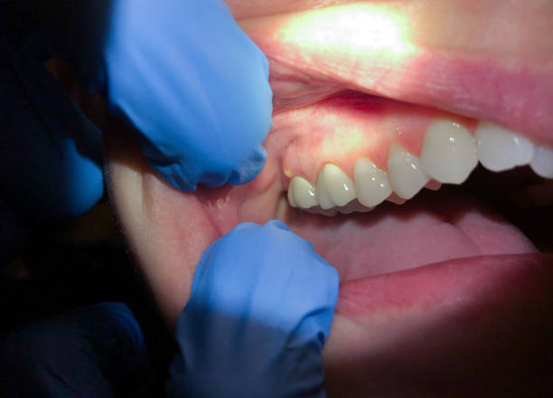 Best Orthodontic Emergency Dentist in Flordell Hills, MO